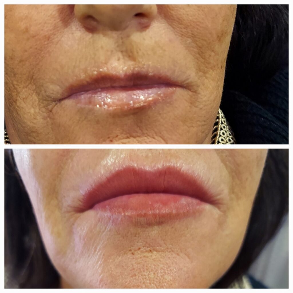 Lip blush with lip enhancement to make lips look fuller